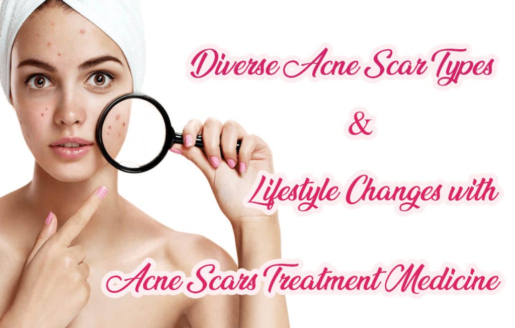 Types Of Acne Scars And Prevention Acne Scars Treatment Medicine