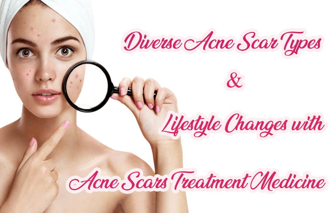 acne scars treatment medicine