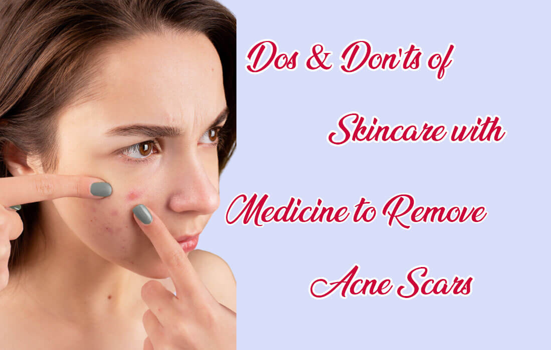 medicine to remove acne scars
