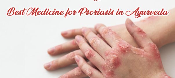 Best Medicine for Psoriasis in Ayurveda