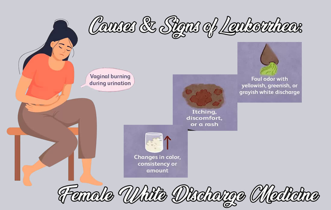 female white discharge medicine