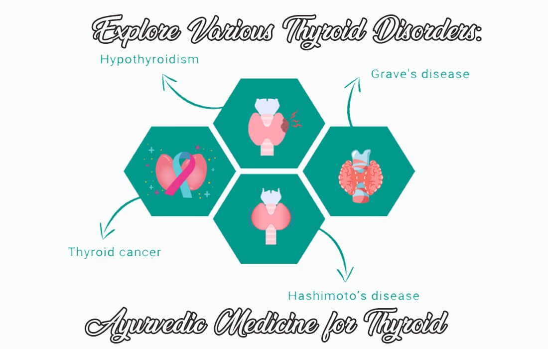 ayurvedic medicine for thyroid